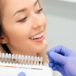 Dentist color matching porcelain veneers Upland for patient smile makeover at Higher Ground Dentistry consultation