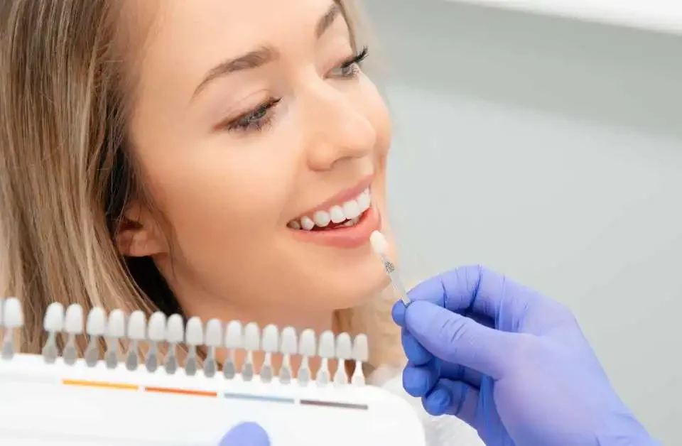 Dentist color matching porcelain veneers Upland for patient smile makeover at Higher Ground Dentistry consultation