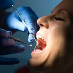 Dentist examining patient for dental filling failure during checkup at Higher Ground Dentistry in Upland California